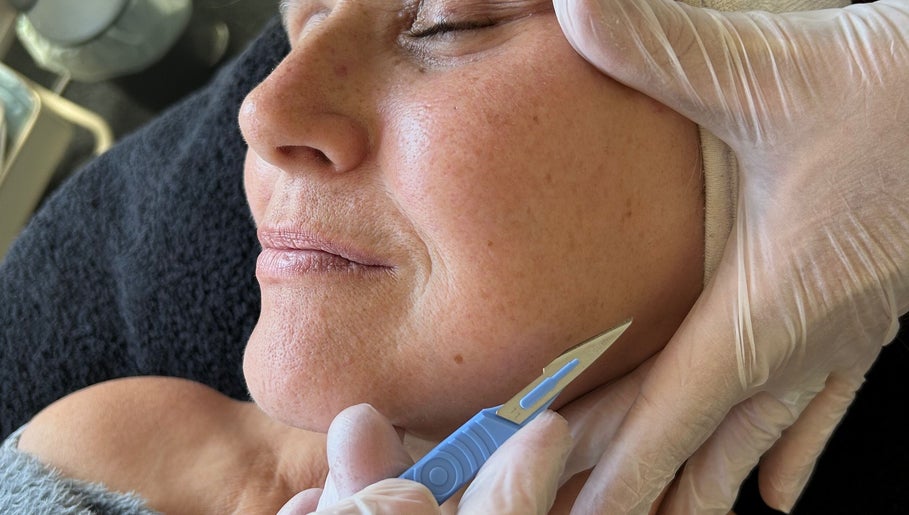 Close-up of dermaplaning treatment at Tips to Toes Nails & Beauty by Joanne, Great Yarmouth, England, GB.
