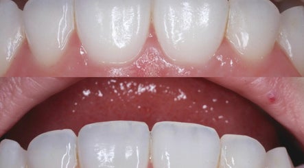 Elite Smile Dental Group afbeelding 3
