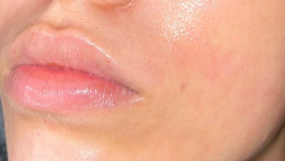 Close-up of glowing, hydrated skin at DS Aesthetics, Dublin W, County Dublin, IE showcasing beauty treatment results.