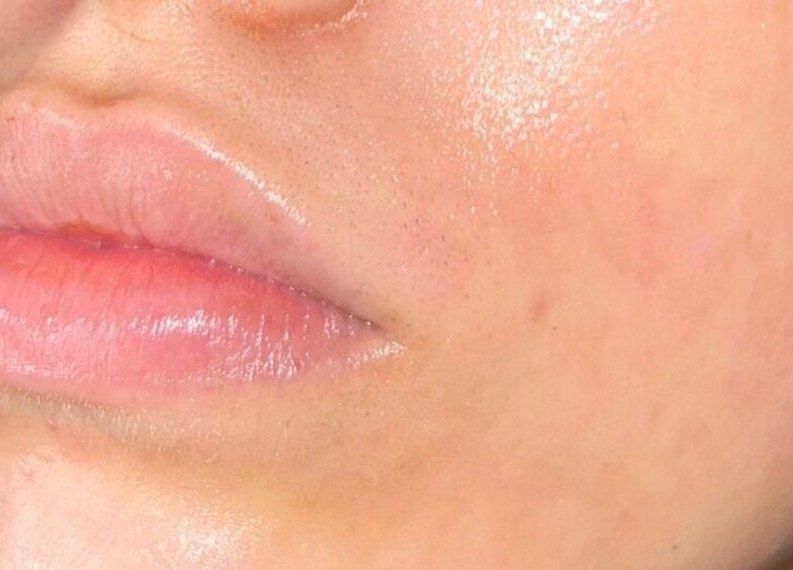 Close-up of glowing, hydrated skin at DS Aesthetics, Dublin W, County Dublin, IE showcasing beauty treatment results.