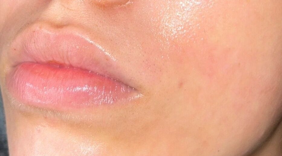 Close-up of glowing, hydrated skin at DS Aesthetics, Dublin W, County Dublin, IE showcasing beauty treatment results.