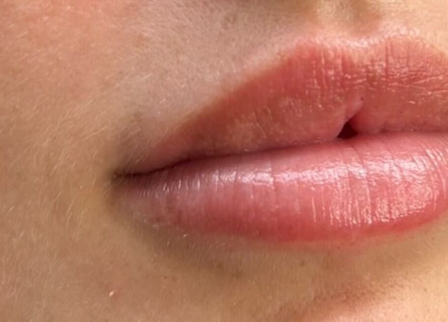 Close-up of enhanced lips at DS Aesthetics, Dublin W, County Dublin, IE, showcasing expert beauty treatment.