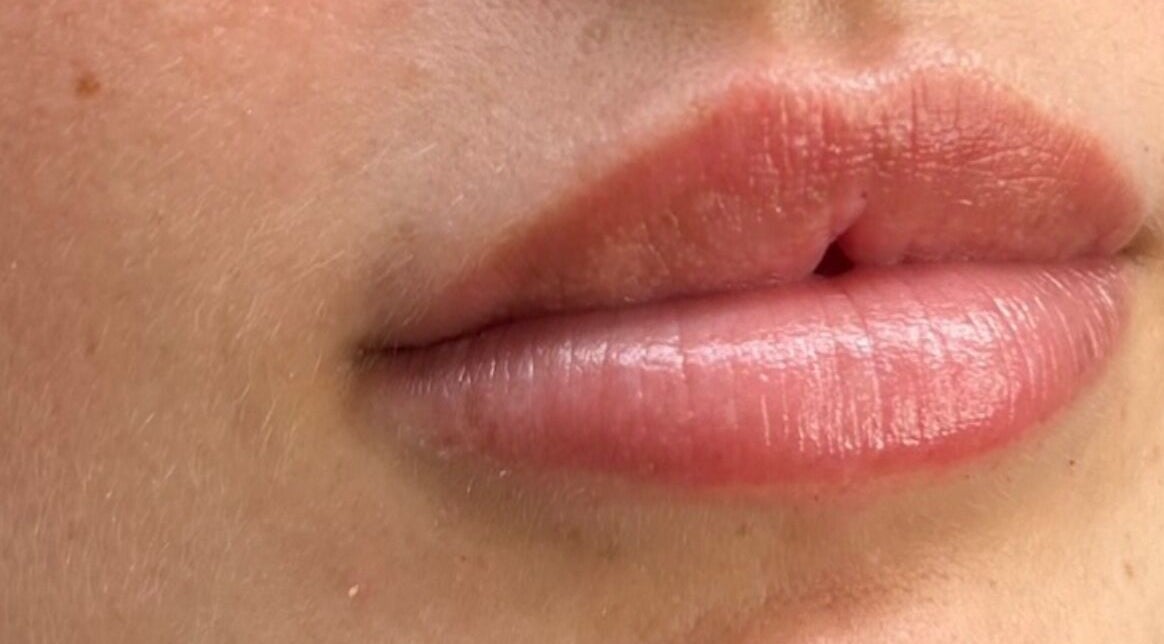 Close-up of enhanced lips at DS Aesthetics, Dublin W, County Dublin, IE, showcasing expert beauty treatment.