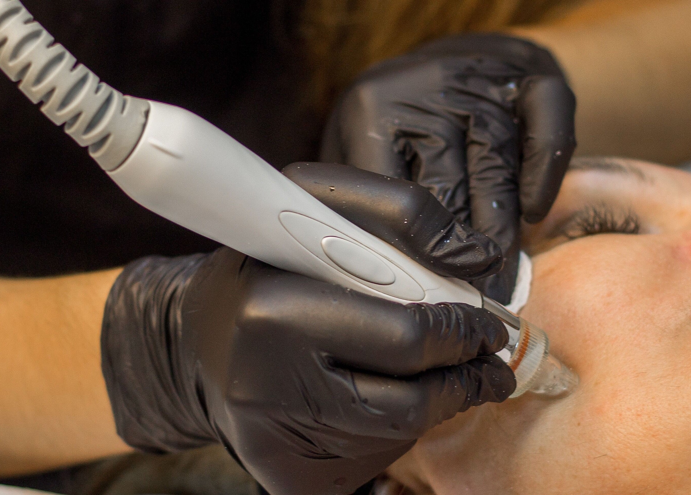 Tratamiento facial en Mímate Estética Avanzada, Torredembarra, Catalunya, ES.