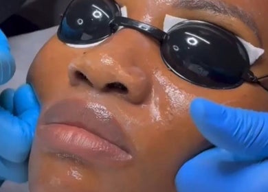 Facial treatment at BeautyHuntt Aesthetics Clinic in Lekki, Lagos, NG, highlighting skin rejuvenation.