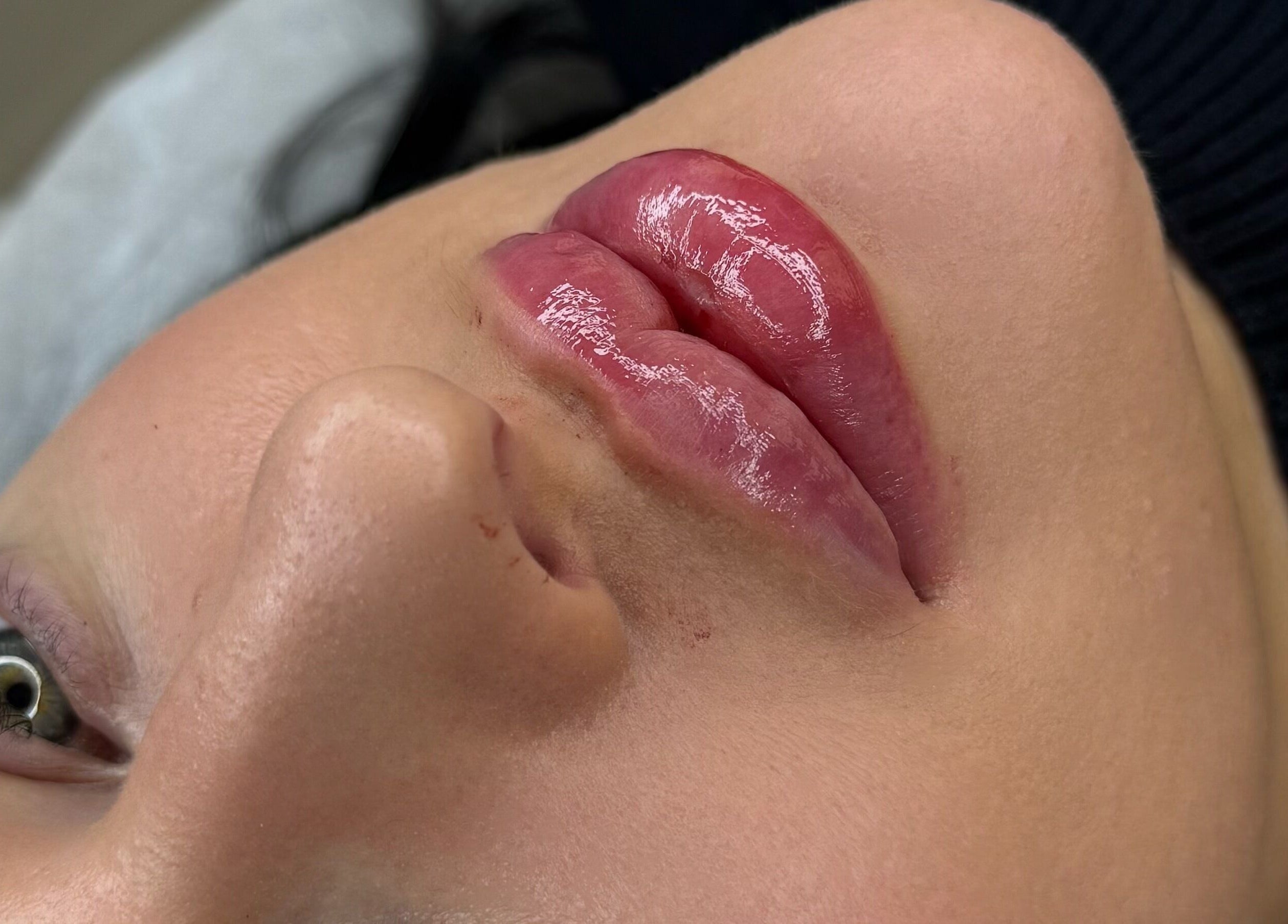 Close-up of glossy lips after treatment at Aesthetic Nurse Marta, Vaughan, Ontario, CA.