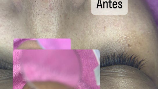 Laser Estetica Bavaro