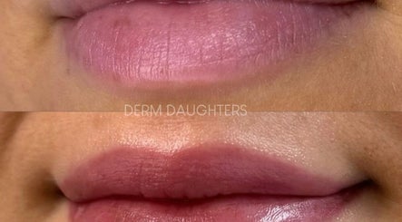 Derm Daughters obrázek 3