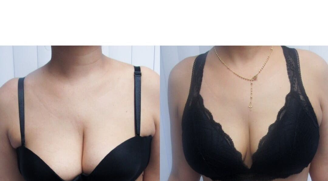 Resultados de realce en el centro VERONA SAMBORONDON, Samborondón, Guayas, EC.