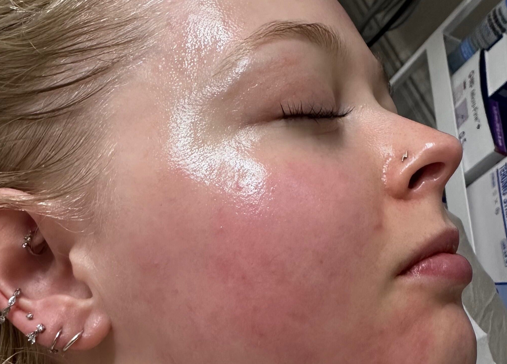 Close-up of radiant skin after facial at Aesthetics by Kinga Jambor, Nottingham, England, GB.