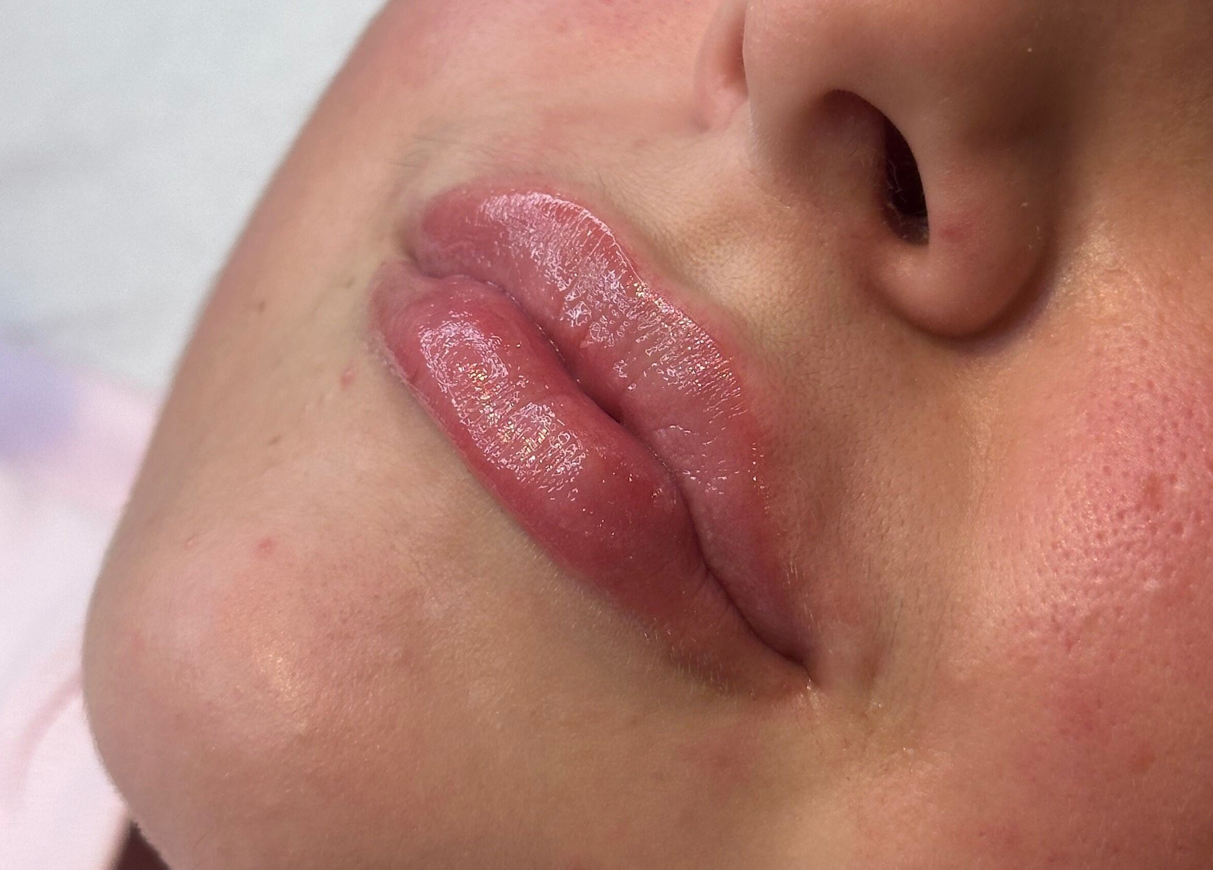 Close-up of glossy lips treated at Skin Serenity, Bishopthorpe, England, GB for a radiant finish.