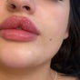 Beauty Fillers Dermal Aesthetics