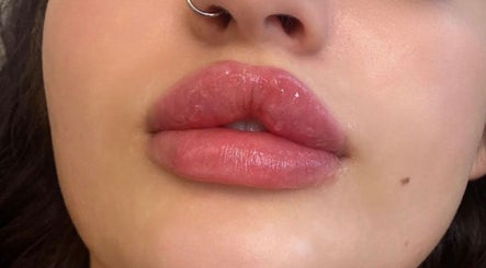 Close-up of enhanced lips at Beauty Fillers Dermal Aesthetics, London, England, GB.