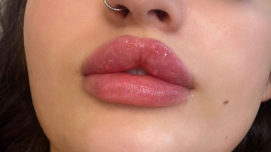 Beauty Fillers Dermal Aesthetics