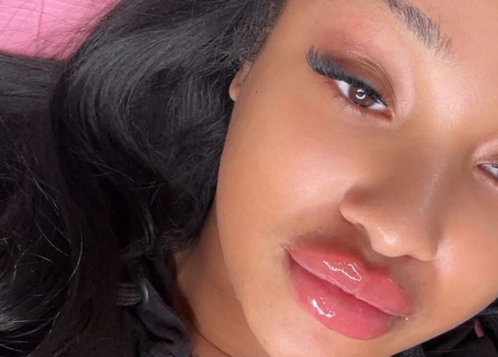 Close-up of radiant skin and glossy lips at Beauty Fillers Dermal Aesthetics, London, England, GB.