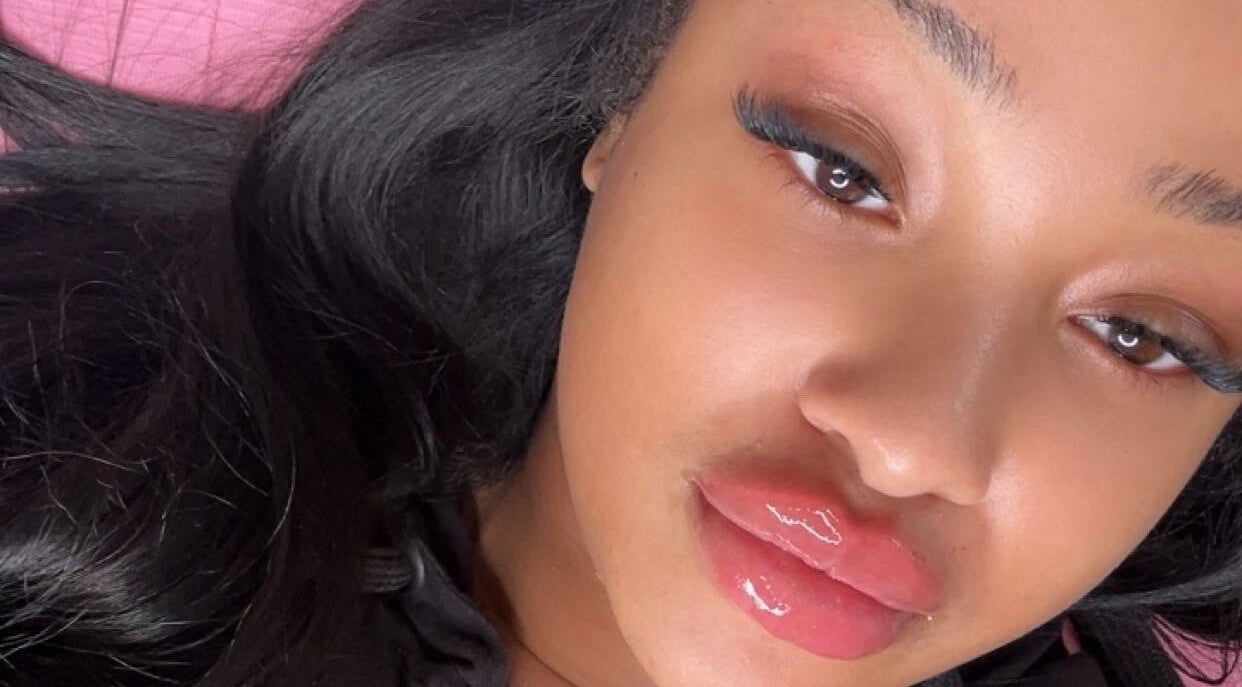 Close-up of radiant skin and glossy lips at Beauty Fillers Dermal Aesthetics, London, England, GB.