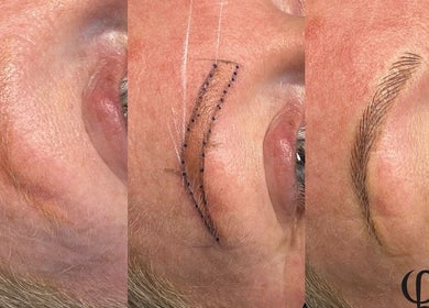 Eyebrow transformation process at Leigh B Makeup & Brows, Drogheda, County Louth, IE showcasing microblading stages.