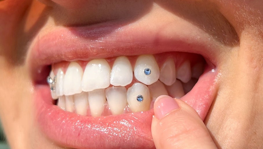 A close-up of tooth gems at Twinkle Tooth Gemz, Saint Peters, New South Wales, AU.
