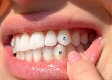 A close-up of tooth gems at Twinkle Tooth Gemz, Saint Peters, New South Wales, AU.