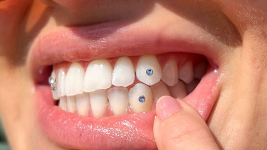A close-up of tooth gems at Twinkle Tooth Gemz, Saint Peters, New South Wales, AU.