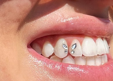 Close-up of a smile adorned with tooth gems at Twinkle Tooth Gemz, Saint Peters, New South Wales, AU.