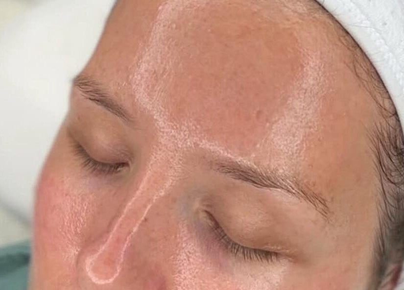 A close-up of a glowing facial treatment at The Skin Specialist, Copthorne, England, GB.