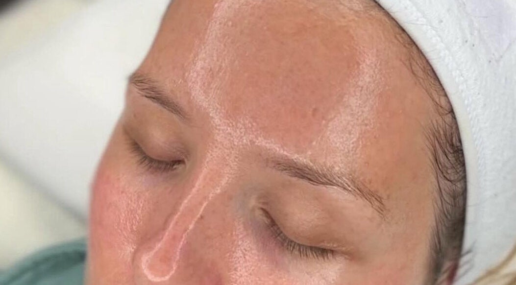 A close-up of a glowing facial treatment at The Skin Specialist, Copthorne, England, GB.