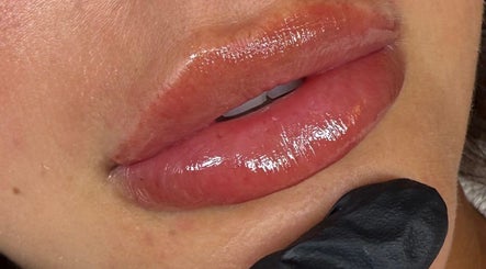 Close-up of glossy lips treatment at Attvara Aesthetics, Great Kingshill, England, GB.