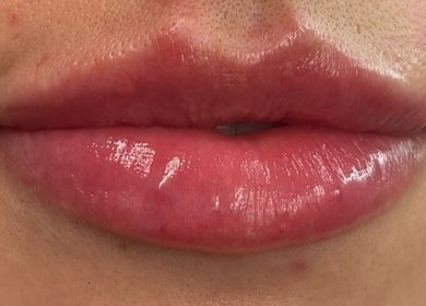 Close-up of glossy lips showcasing beauty treatment at MG Aesthetics Lounge, Bristol, England, GB.