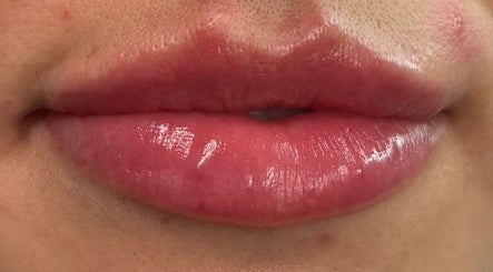Close-up of glossy lips showcasing beauty treatment at MG Aesthetics Lounge, Bristol, England, GB.