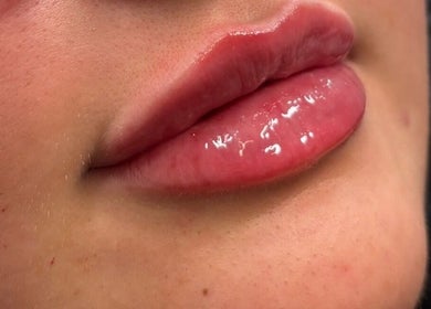 Close-up of glossy lips at MG Aesthetics Lounge in Bristol, England, GB.