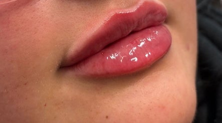 Close-up of glossy lips at MG Aesthetics Lounge in Bristol, England, GB.