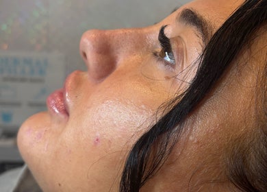 Close-up of glowing skin post-treatment at MG Aesthetics Lounge, Bristol, England, GB.