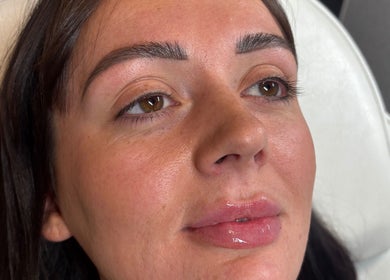 Closeup of a woman's face showcasing skincare at MG Aesthetics Lounge, Bristol, England, GB.