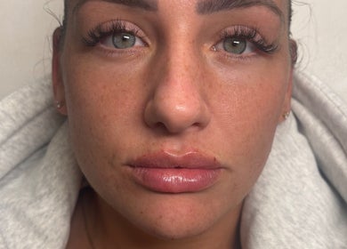 Close-up of facial treatment at MG Aesthetics Lounge, Bristol, England, GB.