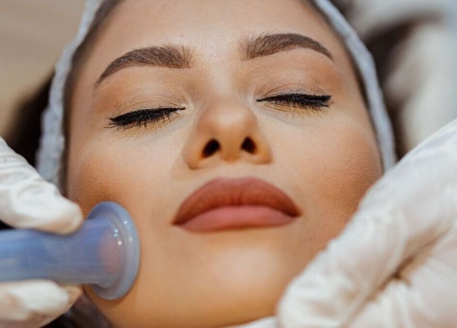 Traitement facial à ventouses au Yogi Tree, Massongy, Auvergne-rhône-alpes, FR pour un teint éclatant.