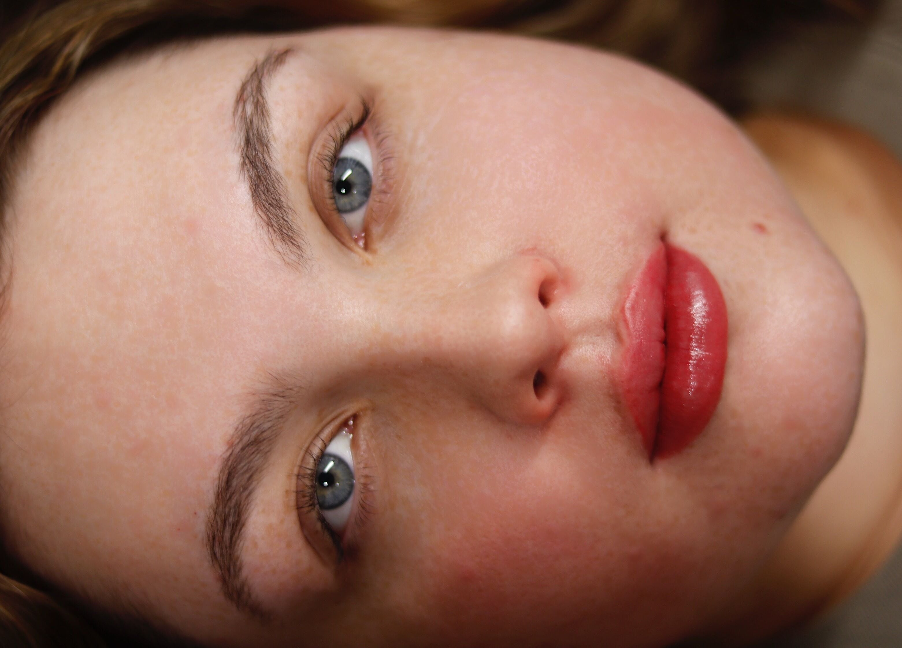 Close-up of a serene face at Dermalink, Wollongong, New South Wales, AU, showcasing rejuvenated skin.