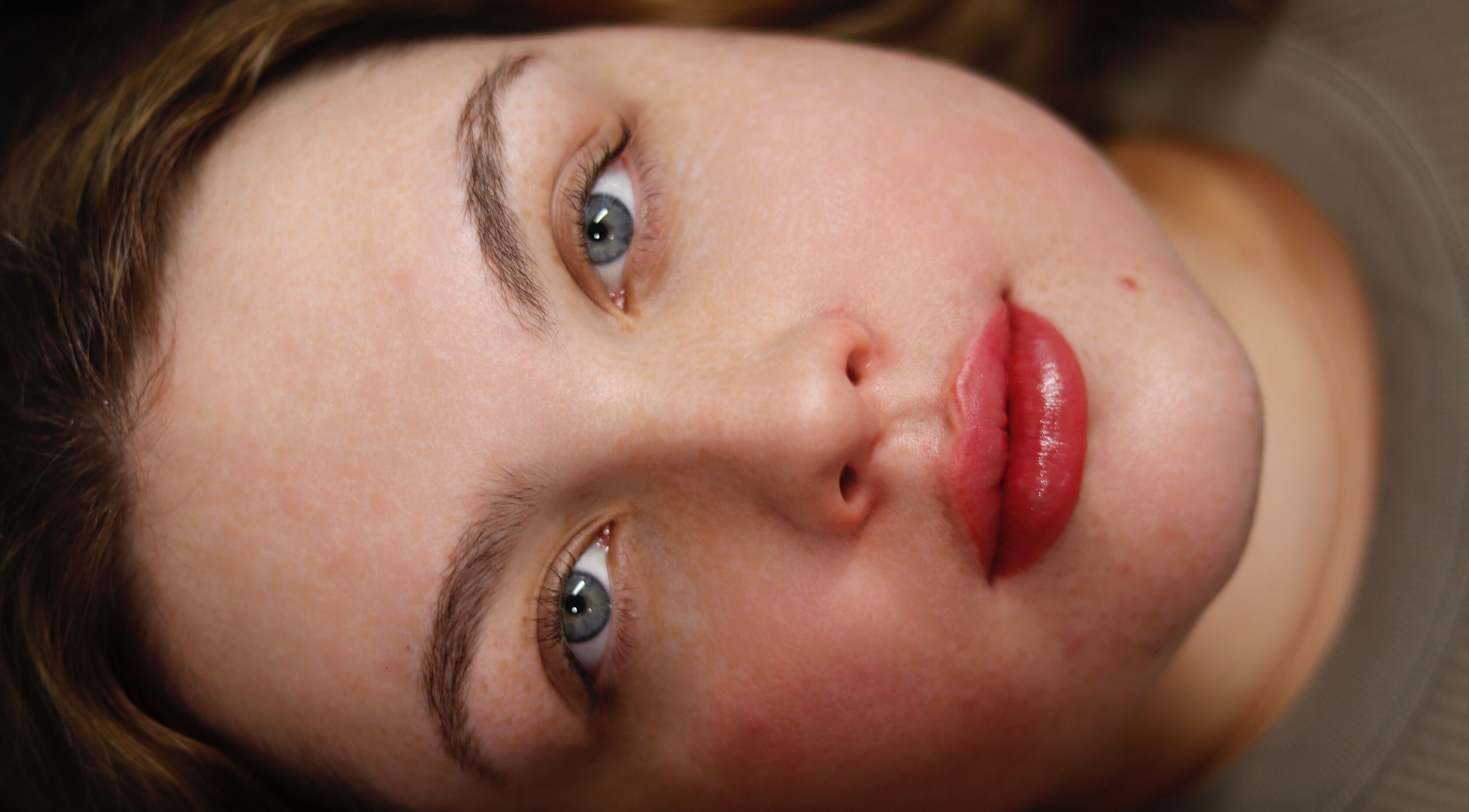 Close-up of a serene face at Dermalink, Wollongong, New South Wales, AU, showcasing rejuvenated skin.