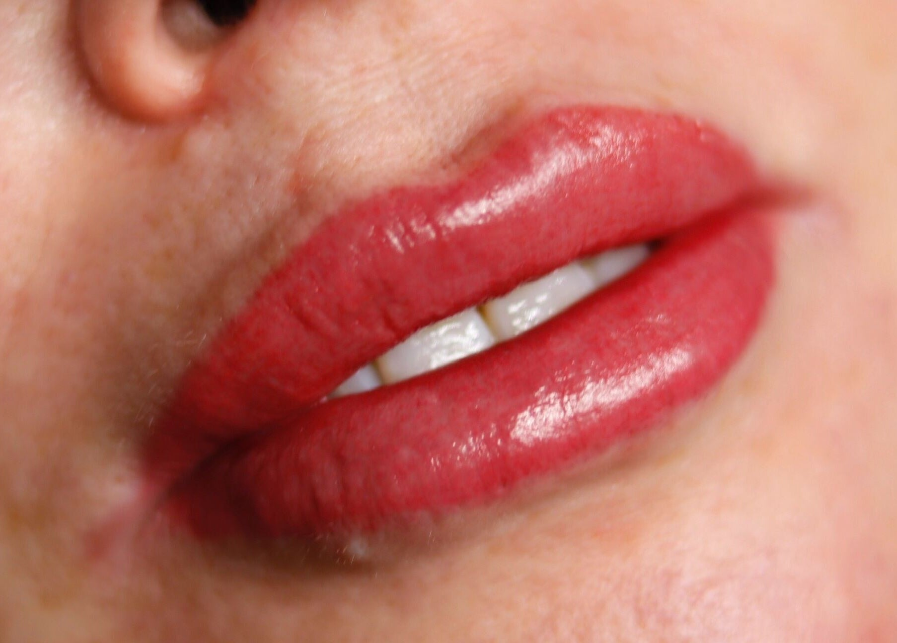 Close-up of glossy red lips showing beauty service at Dermalink, Wollongong, New South Wales, AU.
