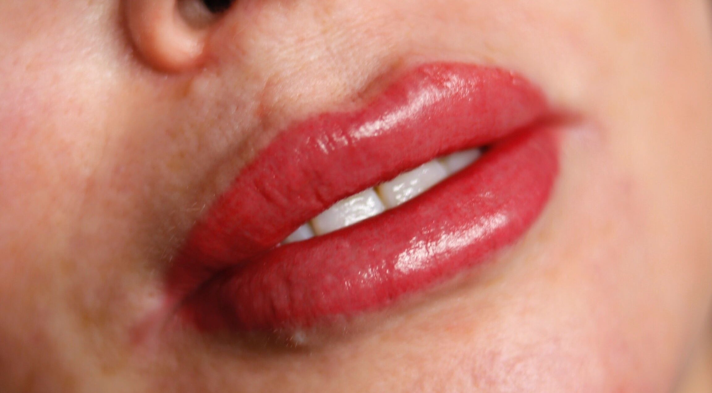Close-up of glossy red lips showing beauty service at Dermalink, Wollongong, New South Wales, AU.