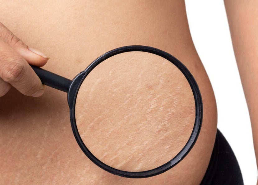Closeup of skin texture under a magnifier at Le Noir Beauty Center, Abu Dhabi, Abu Dhabi, AE.