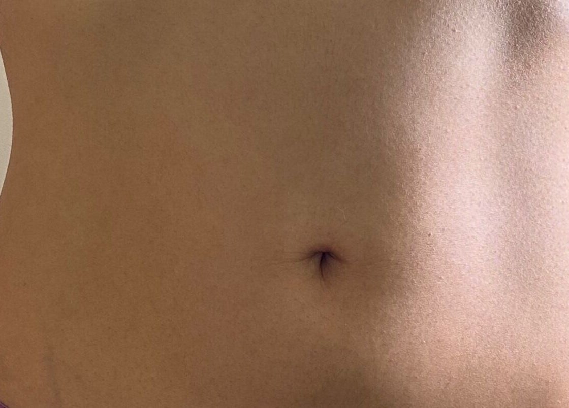 Smooth abdomen at Dyamond Sculpted in Rancho Cucamonga, California, US for beauty enhancement.