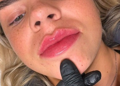 Close-up of a client's freshly treated lips at Shaped Co., Westhoughton, England, GB.