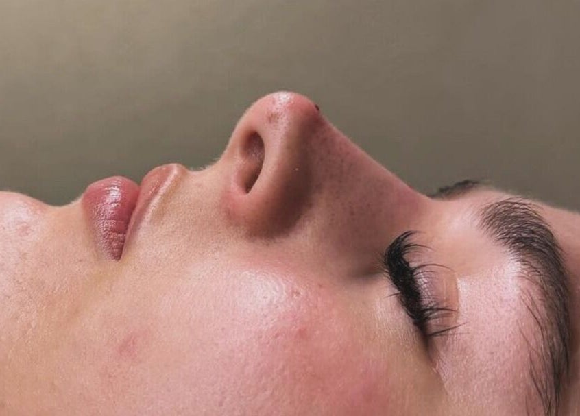 Close-up of serene facial treatment at Signature Skin, Swinton, England, GB, showcasing glowing skin results.