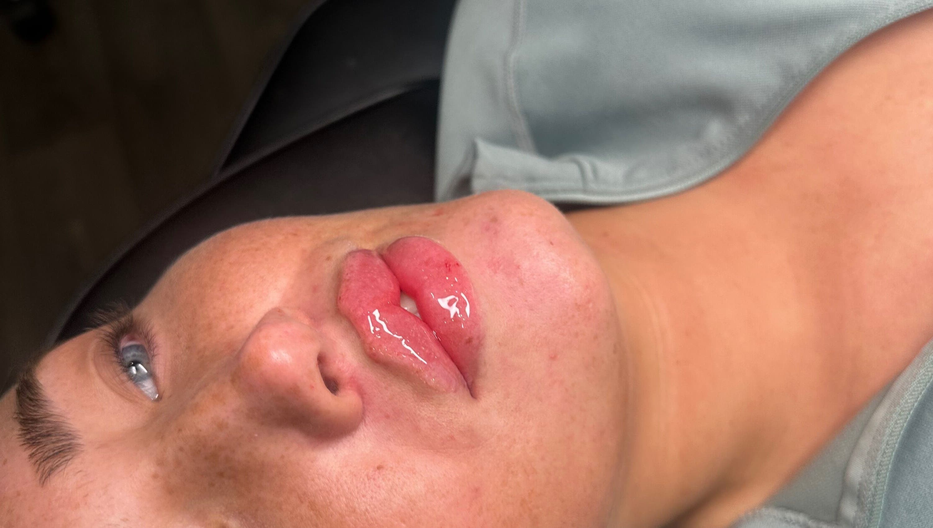 Close-up of lips with gloss treatment at Embassy Aesthetics, Walsall, England, GB.