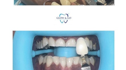 Glow And Go Teeth Whitening East London Ladies Only image 2