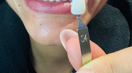 Glow And Go Teeth Whitening East London Ladies Only image 3