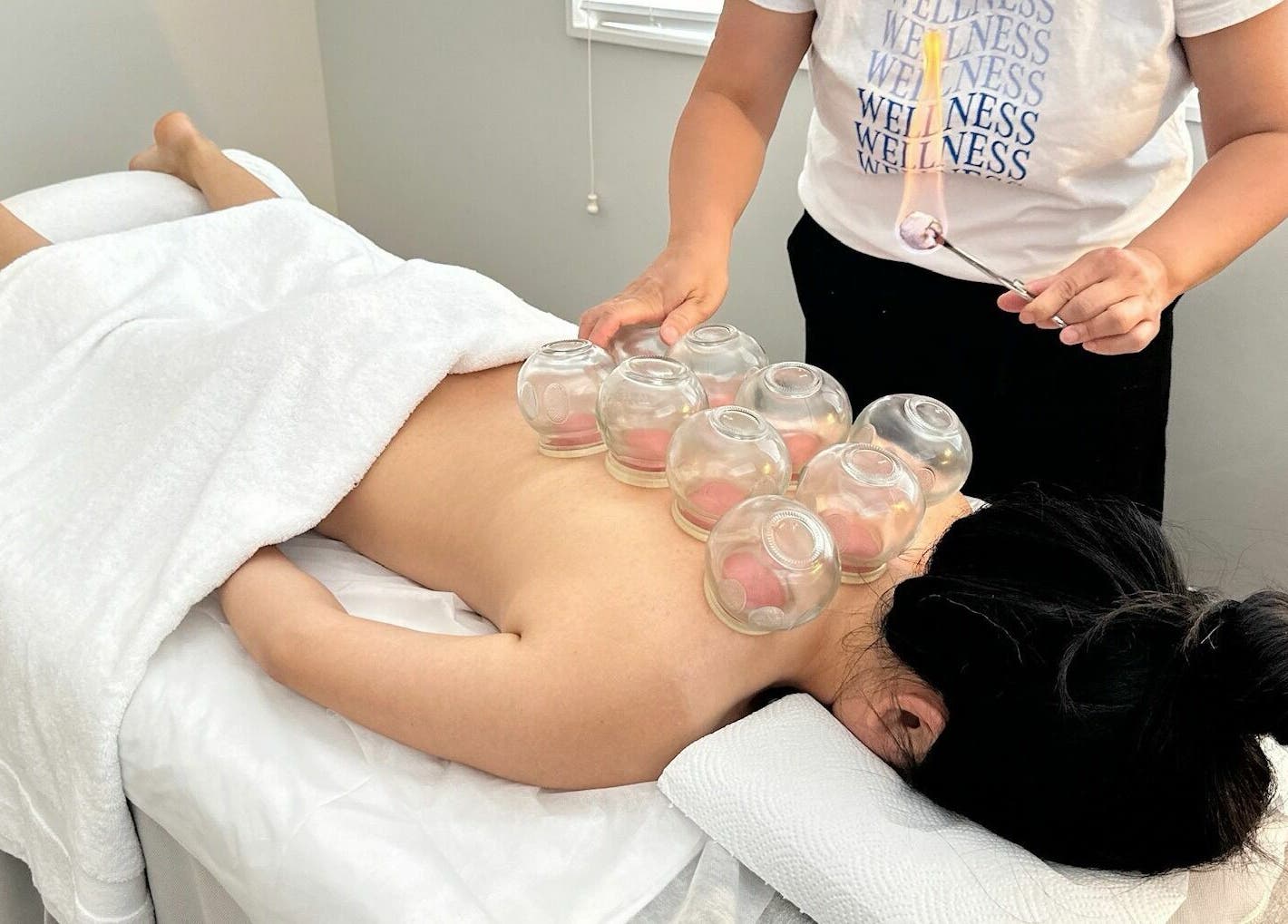 Cupping therapy at Wellness Massage Silverdale, Silverdale, Auckland, NZ, enhances well-being and relaxation.