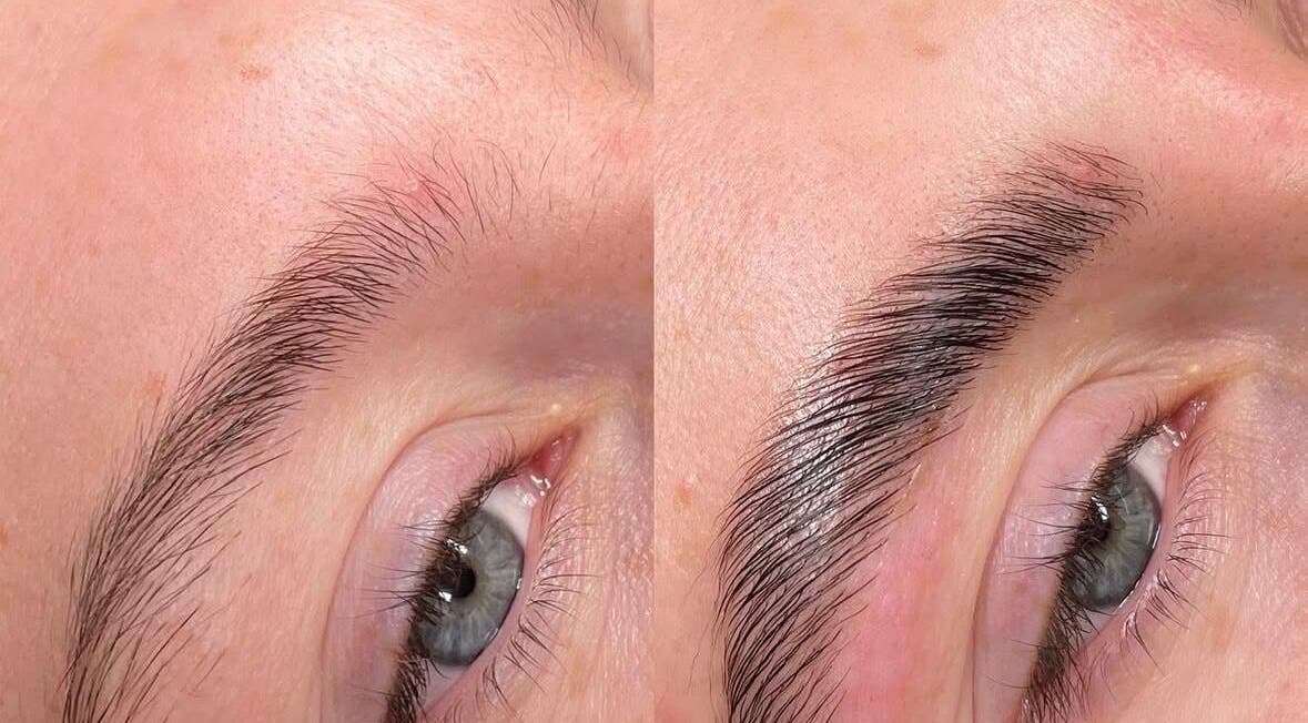 Eyebrow transformation at Cove Skin Clinic in Rainham, England, GB showing before and after results.