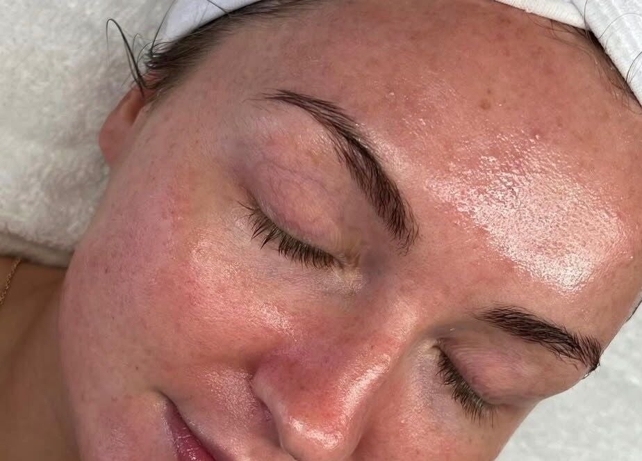 Close-up of a facial treatment at Cove skin clinic, Hornchurch, England, GB, showcasing glowing skin.